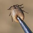 Dr. Pimple Popper Pulls Off Tick With Tweezers
