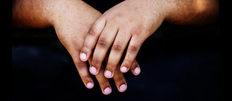 Not all cases of dark knuckles are caused by bleaching
