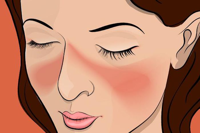 These are the 7 early warning signs of lupus you should watch out for [Credit: Aus Med]