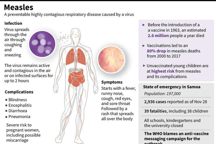 Factfile on measles, a highly contagious disease. An epidemic in Samoa has now claimed 37 lives, according to official data as of Thursday