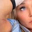 Christie Brinkley Just Posted Her X-Ray Photos