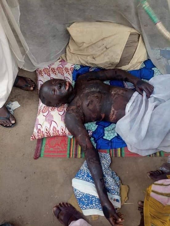 Pretty teenager sets herself ablaze because boyfriend could not afford expensive dowry