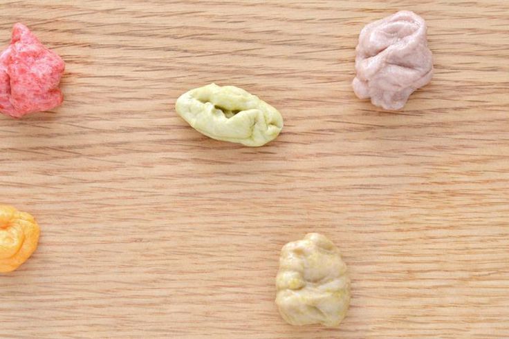 Dr. Pimple Popper Squeezes Pilar Cyst From Scalp