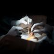 The analysis, published in JAMA Internal Medicine, found that French transplant centers would have transplanted more than 60 percent - about 17,500 kidneys - of the nearly 28,000 deceased-donor kidneys discarded in the United States between 2004 and 20...