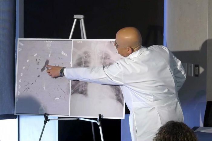 Facing 'Certain Death,' Boy With Vaping Injury Gets Double Lung Transplant