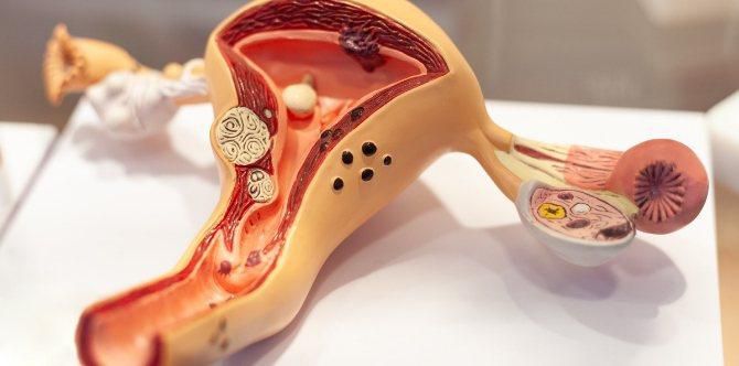 What causes multiple miscarriages: Tests, risk factors and treatment