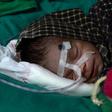 The baby girl, who is in an incubator, is now 'out of danger' and responding to antibiotic treatment, doctors say