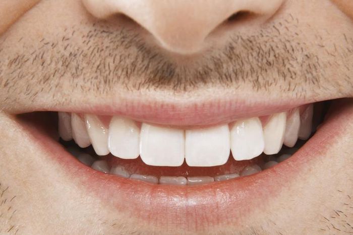 Dr. Pimple Popper Squeezes Smile Cyst