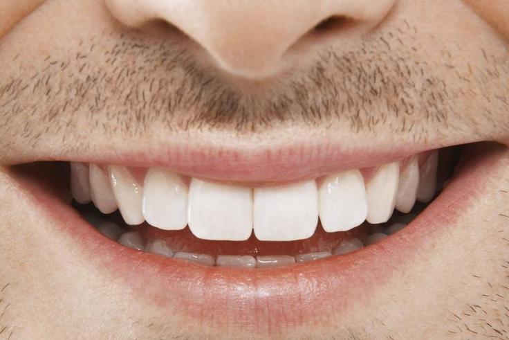 Dr. Pimple Popper Squeezes Smile Cyst