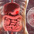 Get to know the 9 glaring stomach ulcer symptoms you can’t ignore [Credit: Web MD]