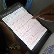 Thousands of heart patients in Ivory Coast are checked by telemedicine each year
