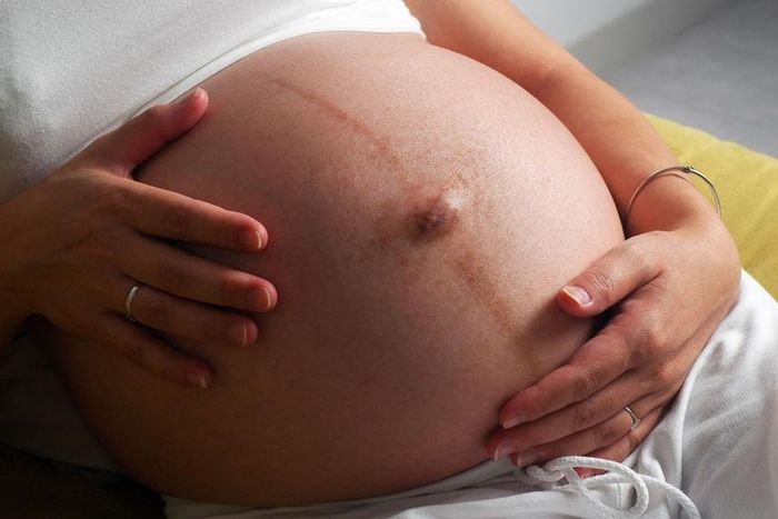 Here are rashes that could occur during pregnancy second trimester