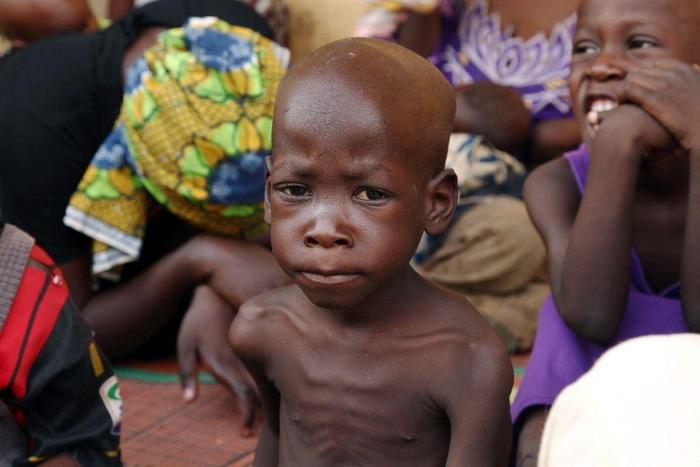 UNICEF says 34,000 children face acute malnutrition in Taraba  [yahoo]