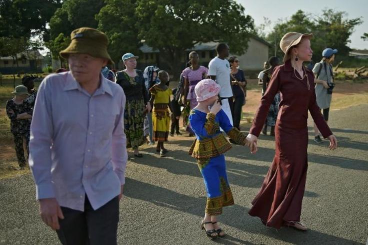 Albinos are killed regularly in some African countries for their body parts for use in witchcraft rituals. Tanzania's Ukerewe island in Lake Victoria, shown here, is seen as a safe place for albinos