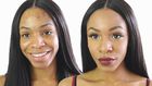 How to clear facial dark spots