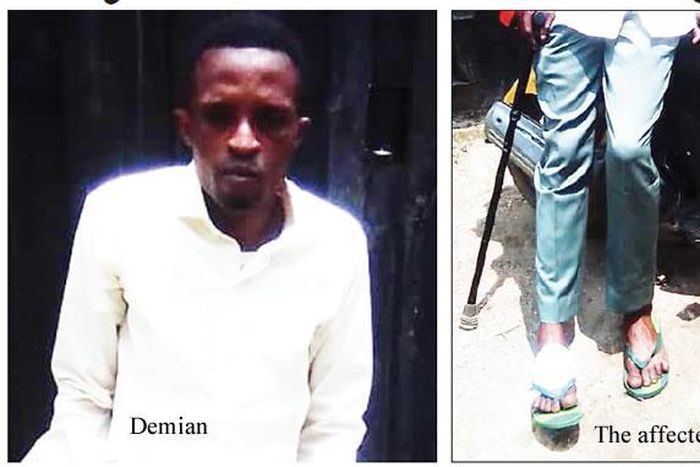 Demian-The-affected-leg