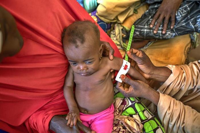 In Nigeria, Aisah Mairo Iddris, a health worker measures a child who is undergoing treatment for malnutrition. [UNICEF/UN0260697/Esiebo]