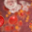 New HIV Strain Discovered