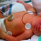 New Jersey Baby Survives Rare Diagnosis