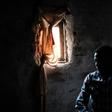 Ebola survivor Claude Mabowa, 21, lost his mother, a brother and sister to Ebola, according to NGO Alima