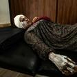 Syrian patient Fatima al-Issa who was hit by shrapnel during Turkish bombardment of Ras al-Ain, rests after receiving treatment at a hospital in the town of Tal Tamr in the countryside of Syria's northeastern Hasakeh province, on October 11, 2019.Ankar...