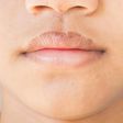 Dry lips