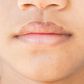 Dry lips