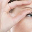 Dr. P Squeezes An Eyebrow Cyst In Slow Motion