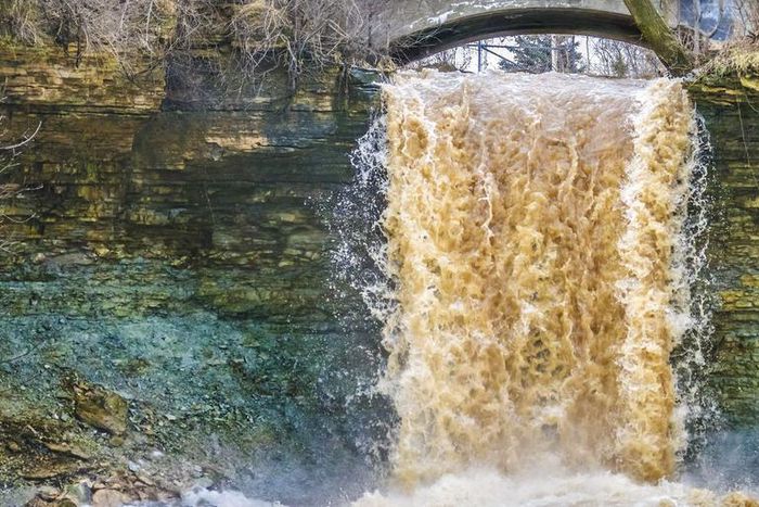 Dr. Pimple Popper Pops Abcess Waterfall