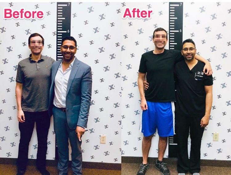 Men are now resorting to limb extension surgery to become taller (video)