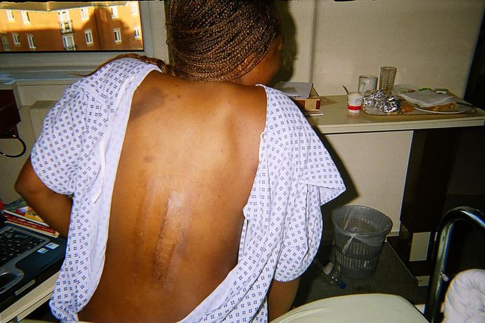 Mary Ephraim on a wheelchair in the hospital after an accident caused by an Addax hit and run driver (Pulse)