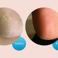 This Callus Remover Will Give You Baby-Soft Feet