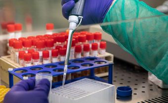Where Did Novel Coronavirus Originate?