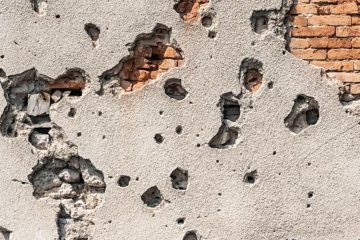 Watch Dr. Pimple Popper Pop All The Blackheads