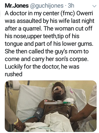 Wife cuts off doctor husband’s nose, tongue, teeth, gums before calling his mom to come for the corpse