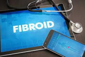 Fibroid [ Comtemporary OBGyn]