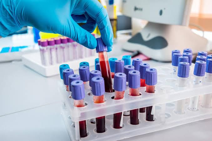Nigeria's healthcare sector gets major boost with new specialised facility to tackle cancer