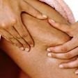 cellulite