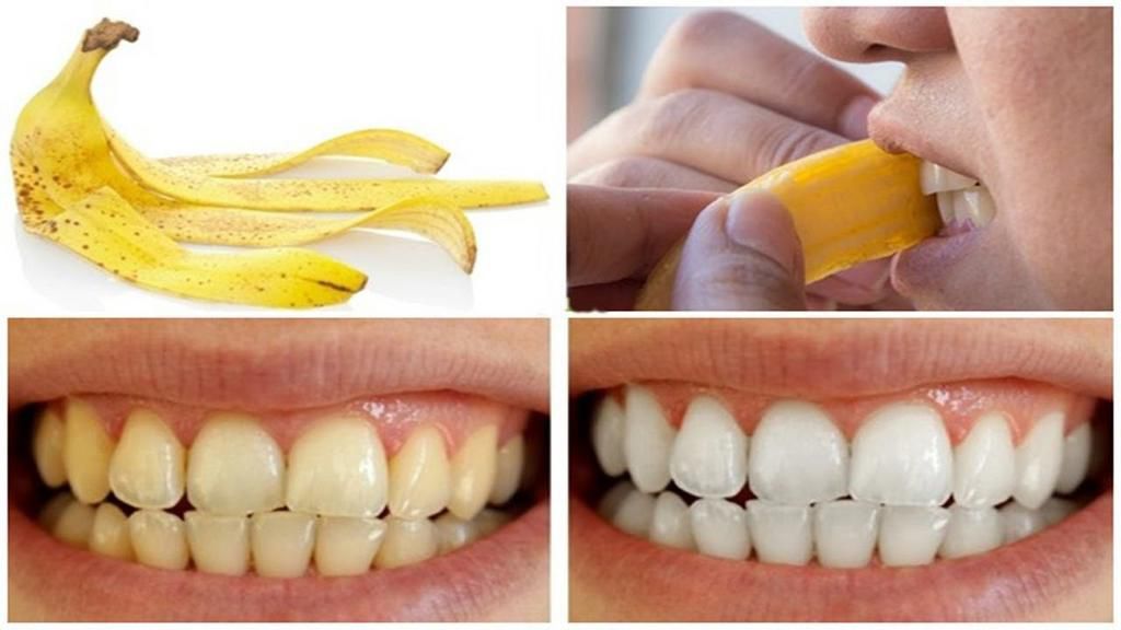 How to whiten the teeth using banana peels