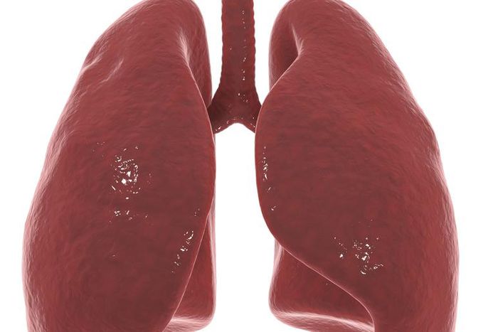 Dr. Pimple Popper Removes a Giant 'Organ' Lipoma