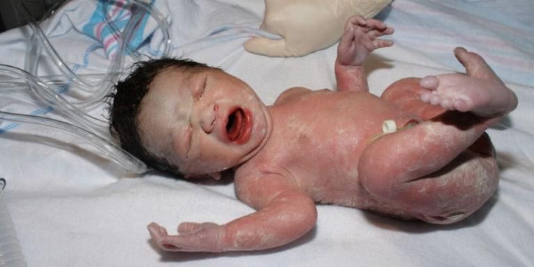 How to take care of a newborn baby after birth