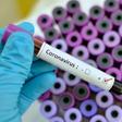 coronavirus blood specimen (GETTY Images)