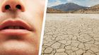 Why You Have a Dry Mouth—and How to Fix It