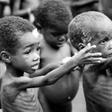 Boko Haram: 3 children die daily of malnutrition in Borno - UNICEF/Illustration. [pmnewsnigeria]