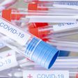 Are At-Home Novel Coronavirus Test Kits Accurate?