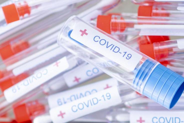 Are At-Home Novel Coronavirus Test Kits Accurate?