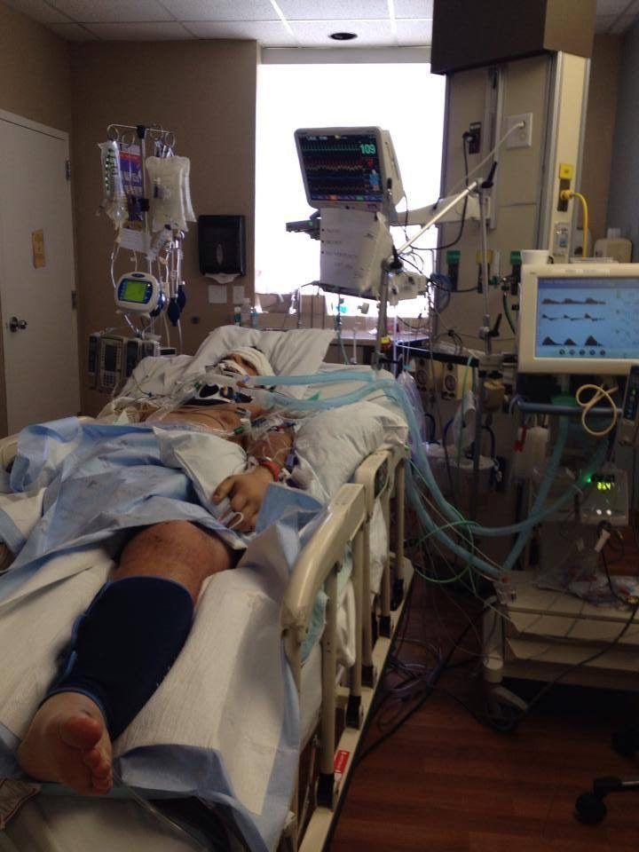 He Was in a Coma. Now He Deadlifts 405 Pounds.