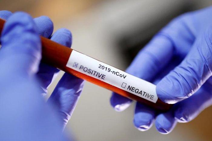 Health CS Mutahi Kagwe confirms 9 new cases of Coronavirus, total rises to 25 with 4 counties affected - Nairobi, Mombasa, Kwale, Kilifi