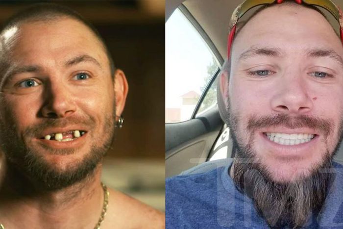 'Tiger King' Star John Finlay Got New Teeth