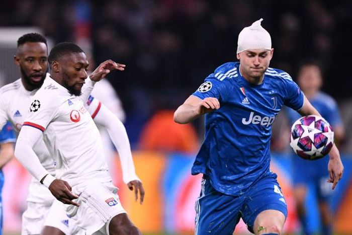 Matthijs de Ligt, his head heavily bandaged, takes on Karl Toko-Ekambi in the Champions League last-16 first leg between Lyon and Juventus
